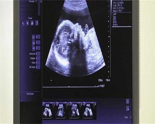 打破血咒--第三代借卵试管婴儿助力脱贫