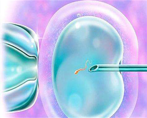 -欧易_哪个医院做代孕好