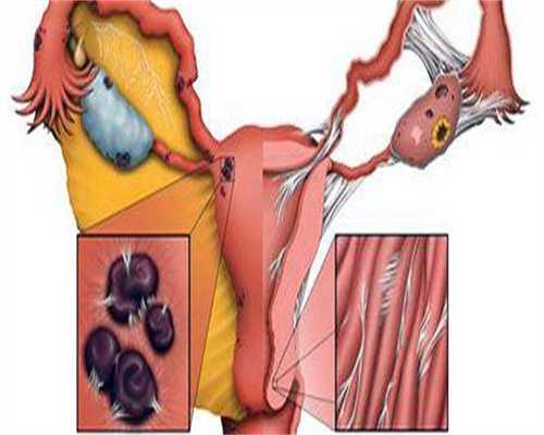 北京助孕宝宝干呕怎么回事