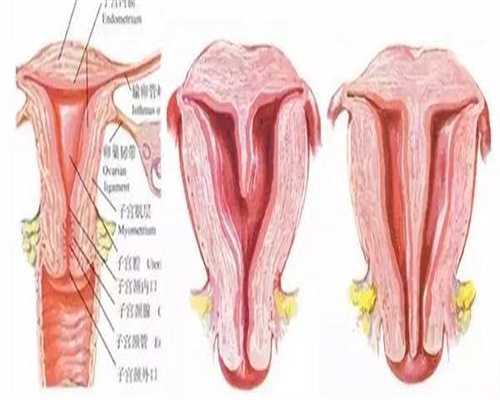 霉菌阴道炎有哪些症状？