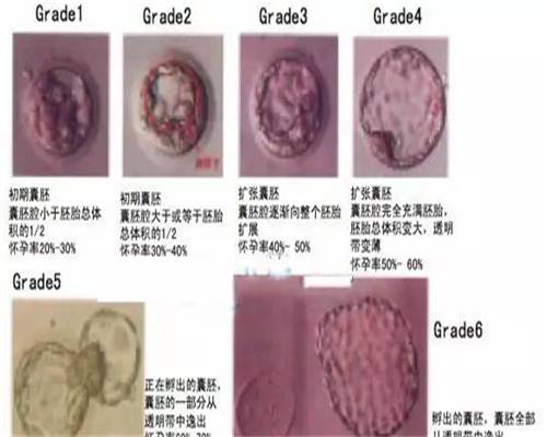 代孕供卵费用:九点打夜针几点促排卵？