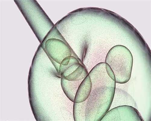 试管代怀生子费用大概要多少？试管附费用一览？