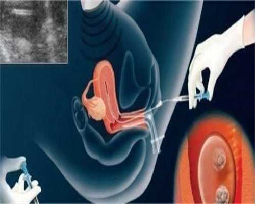 供卵多少钱一支_供卵三代试管,北京供卵中心|供卵试管费用|供卵试管能怀男孩