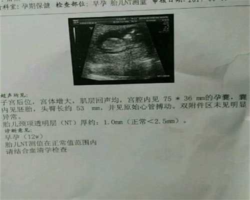 去上海代孕多少钱_女性分娩姿势