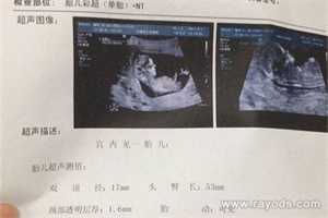 北京代孕协议`北京供卵在哪`北京做试管经期都检查什么