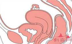 代孕网-正常人可以代孕么-代孕妇睡觉睡得腰酸背痛为什么