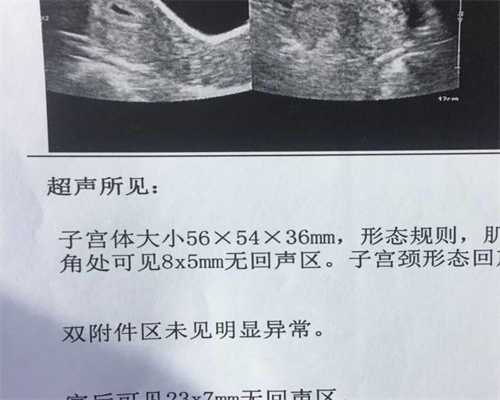 北京代孕生子的价格是多少_北京代孕QQ群