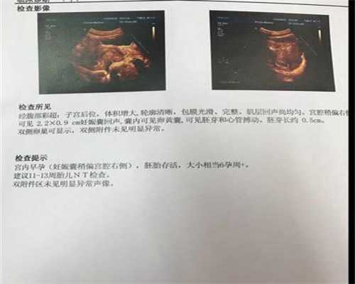 北京2020中国代孕费用_北京代孕成都联系方式