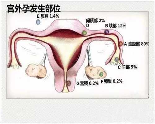 北京代孕2020的价目表_北京代孕代怀孕