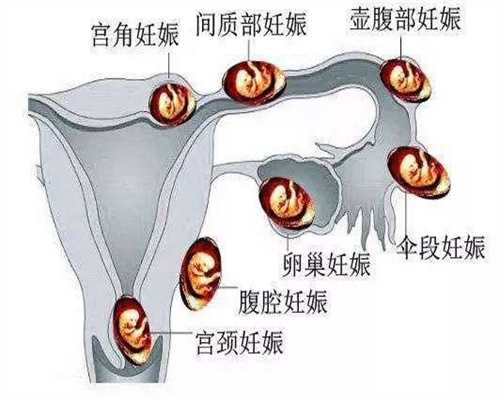 北京代怀孕双胞胎价格表_北京代孕总计费用要多少钱