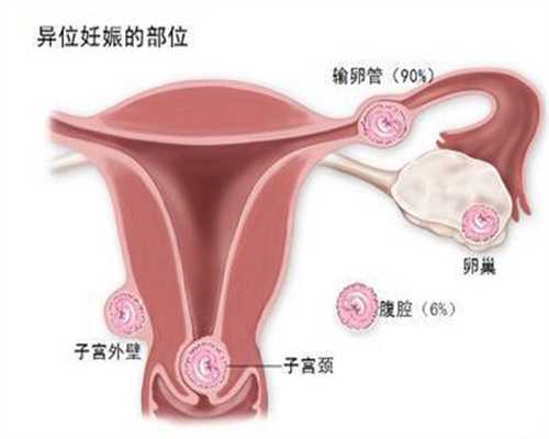 北京找个代孕生孩子_北京代孕双胞胎的公司