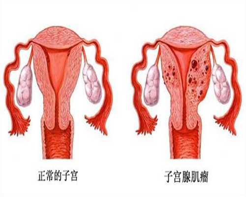 <b>北京合法代孕费用大概多少_北京代孕哪里最专业</b>