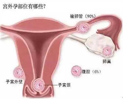 北京代孕包生女孩多少钱_北京2020中国代孕费用