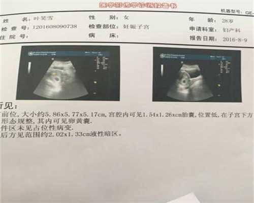 北京代孕可以在医院做吗_北京代孕网神州中泰代孕网