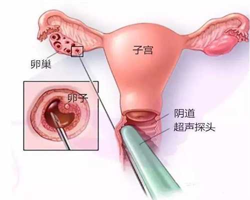 <b>北京代孕怎么找靠谱公司_北京代孕试管大概需要多少钱</b>