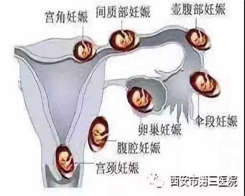 北京代孕中介哪里专业_北京代孕网价格