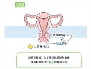 想找代孕的-北京找靠谱代孕_2022北京做试管婴儿哪家医院最好？北京十大试管医