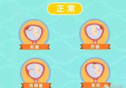 北京有供卵试管生小孩的吗_怀孕了，胎盘位于前壁会有危险吗？