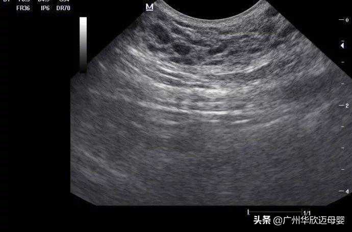 北京去哪里找助孕_北京助孕那个医院_医生：十月怀胎，最全的每月产检知识！